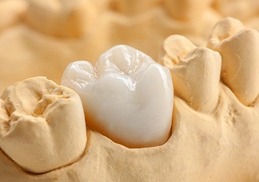 Model tooth with dental crown