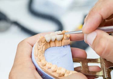 young woman smiling at her dentist