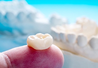 dentist in Garland holding a dental crown on their finger