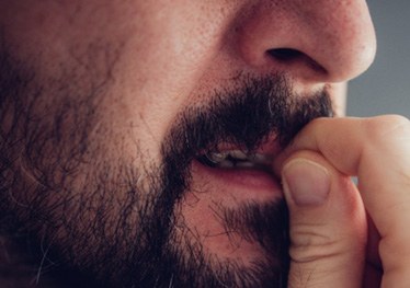 man biting fingernails