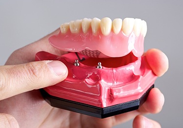 Garland implant dentist holding implant dentures in Garland