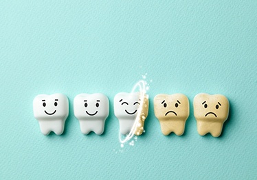  Illustration of teeth whitening