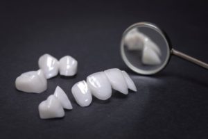 examples of veneers being shown by a dentist