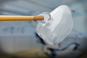 Animated model of dental veneer.